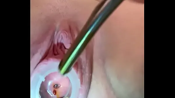 Tonton Painful cervix fucking 8mm Tube baru